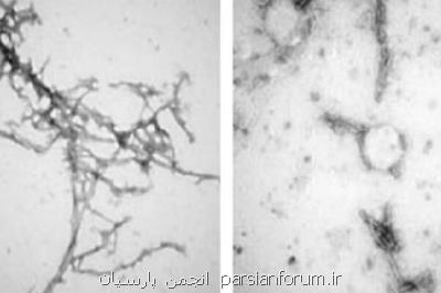پاکسازی پروتئین های عامل بیماری پارکینسون با نانو بادی