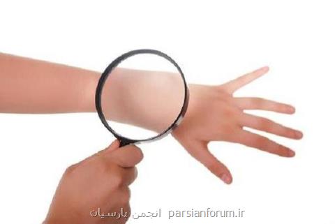 یك كشف جدید رشد سرطان پوست را متوقف می كند