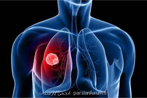 ثبت دو اختراع ایرانی برای درمان بیماری های انسدادی ریه