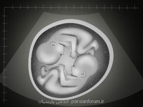 دومین دوقلوهای نیمه همسان جهان ۴ ساله شدند