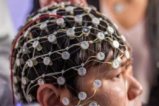 پژوهشگران برای طراحی و ساخت سیستم تحریك مغزی رقابت می كنند